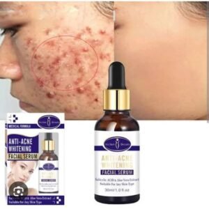 Aichun Beauty Medical Formula Anti-Acne Whitening Facial Serum-30ML
